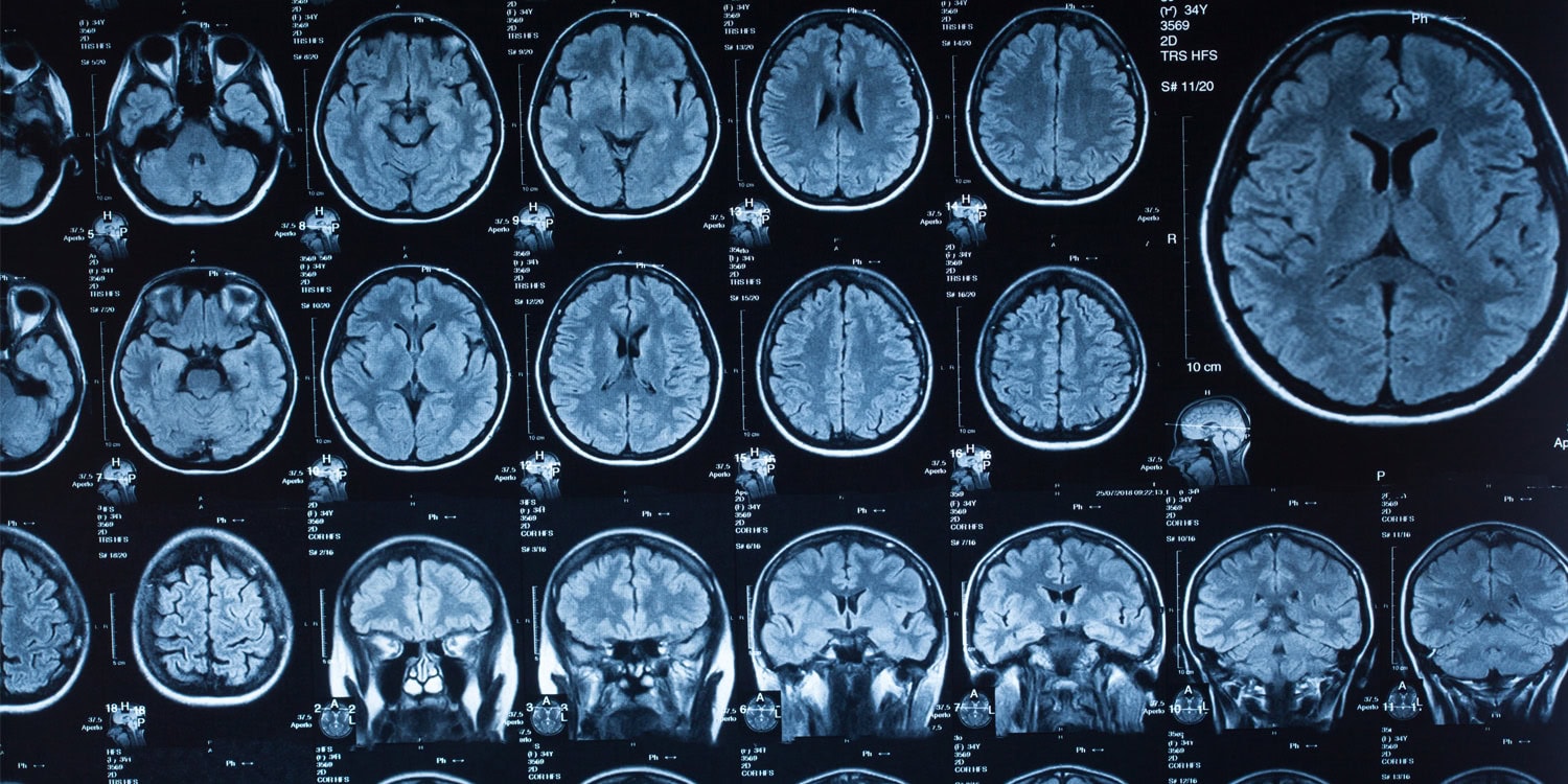 Twój mózg ma pięć faz życia. 32 rok to punkt zwrotny