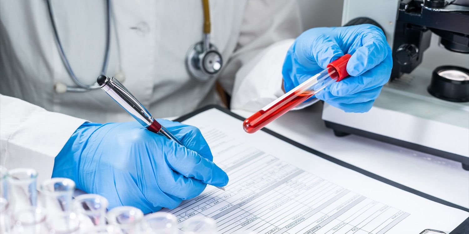 Test krwi na Alzheimera działa inaczej u kobiet i mężczyzn